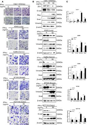 Targeting MDK Abrogates IFN-γ-Elicited Metastasis inCancers of Various Origins